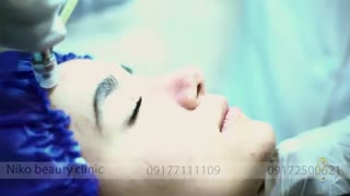 میکرودرم در کلینیک تخصصی پوست و مو و لیزر نیکو آکنه