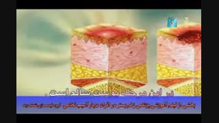 فیلم آموزشی پزشکی زخم بستر در افراد دچار آسیب نخاعی