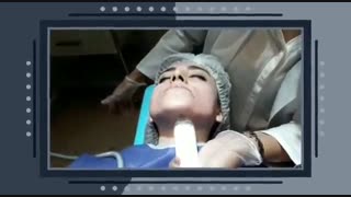 رفع غبغب بدون جراحی آکنه