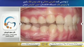 بهترین ارتودنسی | دکتر داودیان
