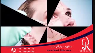 تزریق بوتاکس | فیلم تزریق بوتاکس | کلینیک پوست و مو رز10