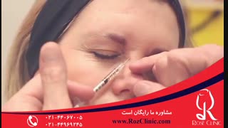 تزریق بوتاکس | فیلم تزریق بوتاکس | کلینیک پوست و مو رز11