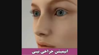 انیمیشن جراحی بینی