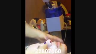 پاکسازی صورت - کلینیک زیبایی پری سیما - 22807060