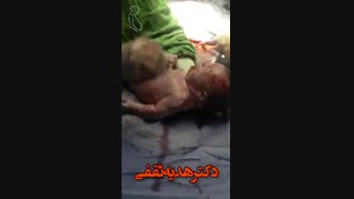 زایمان سزارین توسط دکتر هدیه ثقفی