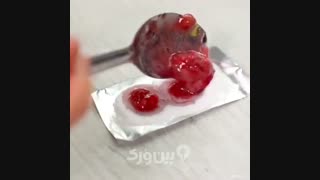 سفید کردن دندان ها با جوش شیرین