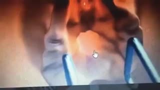 جوانسازی دستگاه تناسلی خارجی