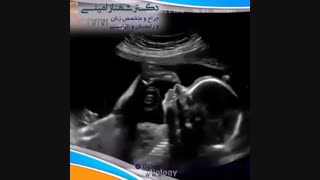 سونوگرافی بارداری
