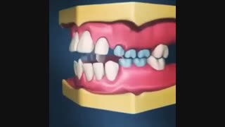 تاثیر مکیدن انگشت بر سلامت دهان و دندان کودک