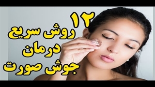 ۱۲ روش سریع درمان جوش صورت