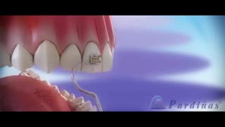 ارتودنسی دندان در بهترین نقطه تهران – کلینیک  دندانپزشکی تاج