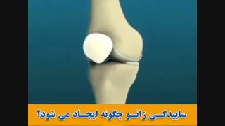 علت ایجاد ساییدگی زانو