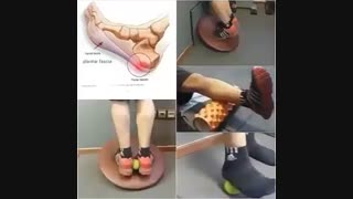 درمان درد کف پا