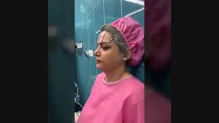 لیفت آندوسکوپیک ابرو