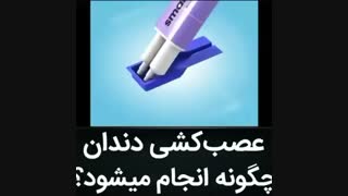 عصب کشی دندان چگونه انجام می شود؟