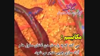 انواع روش های #لاغری_موضعی #کویتیشن