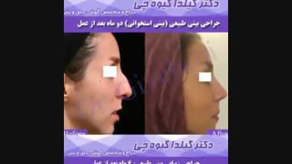 نمونه کار جراحی زیبایی گوش