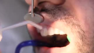 8 واحد ونیر کامپوزیت در کلینیک مدرن