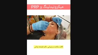 یک روش فوق العاده برای رفع جای جوش