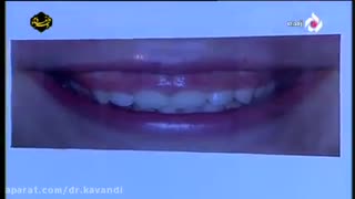 اصلاح طرح لبخند شبکه 5