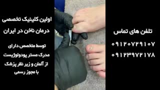 درمان ناخن فرو رفته در گوشت