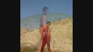 حسین جوکار فرزند عیسی جوکار کاشت ابرو
