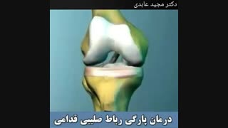 درمان پارگی رباط صلیبی قدامی