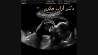 سونوگرافی در شهرک غرب