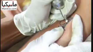 پاک کردن تاتو و خالکوبی بدن - 09199696190