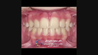 دکتر داودیان | متخصص ارتودنسی