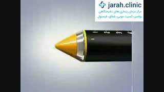 درمان قطعی و بدون بازگشت بواسیر یا هموروئید در کلینیک نوین