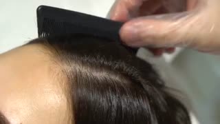 آموزش تزریق محلول مزوتراپی برای مو