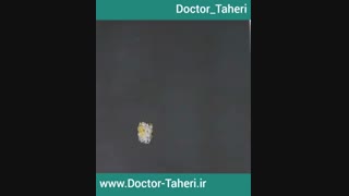 تصور غلط تاثیر میوه بر هضم غذا