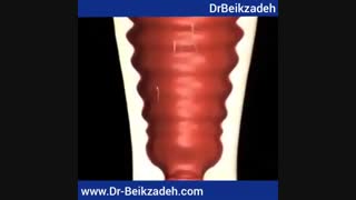 لقاح و جایگزینی جنین