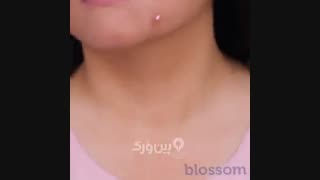 رفع سیاهی زیر بغل