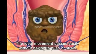 شقاق مقعد چیست و چگونه بوجود می‌آید؟