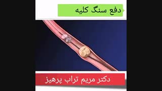 دفع سنگ کلیه