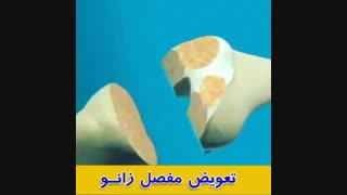 فیلم تعویض مفصل زانو