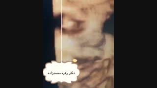 سونوگرافی جنین