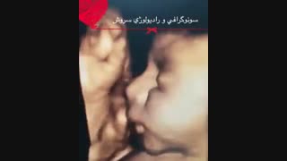 سونوگرافی بارداری