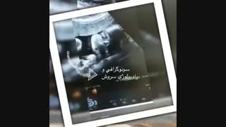 سونوگرافی صورت جنین ١٧ هفته
