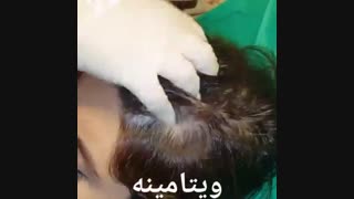 ویتامینه مو - کلینیک زیبایی پری سیما - 22807060