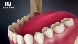 مسواک زبان | دکتر لیلا عطایی پیلینگ شیمیایی