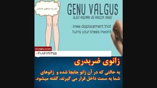 زانوی ضربدری