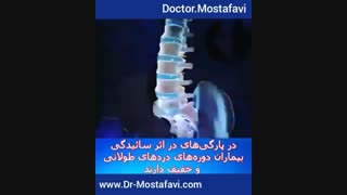 دیسک کمر عارضه ای دردناک ولی قابل درمان