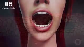 نور فلورسنت و معاینات دندانپزشکی | دکتر لیلا عطایی