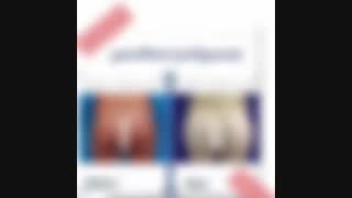 پروتز باسن !!!!