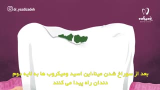مصرف شیرینیجات و روند پوسیدگی دندانی | کلینیک دندانپزشکی دکتر یزدی زاده جوانسازی پوست