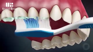 مسواک مناسب | دکتر لیلا عطایی