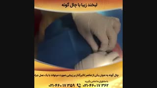فیلم عمل چال گونه